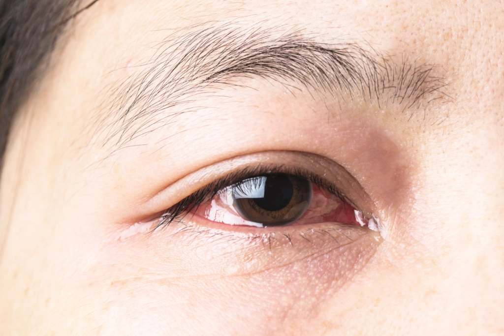 Eye Health & Natural Treatment in Abu Dhabi