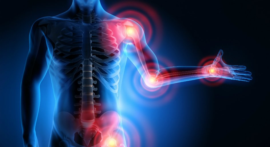 Musculoskeletal Disorders​