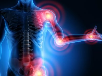 Musculoskeletal Disorders​