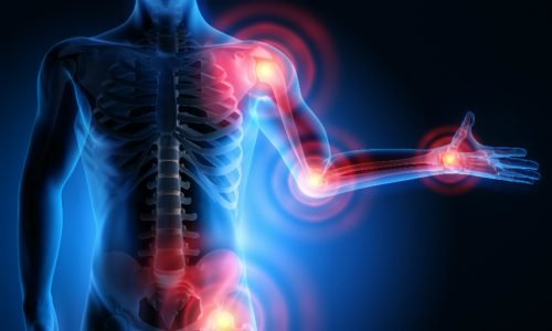 Musculoskeletal Disorders​